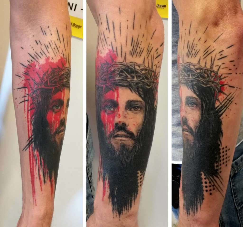 vollständig abgeheilt
